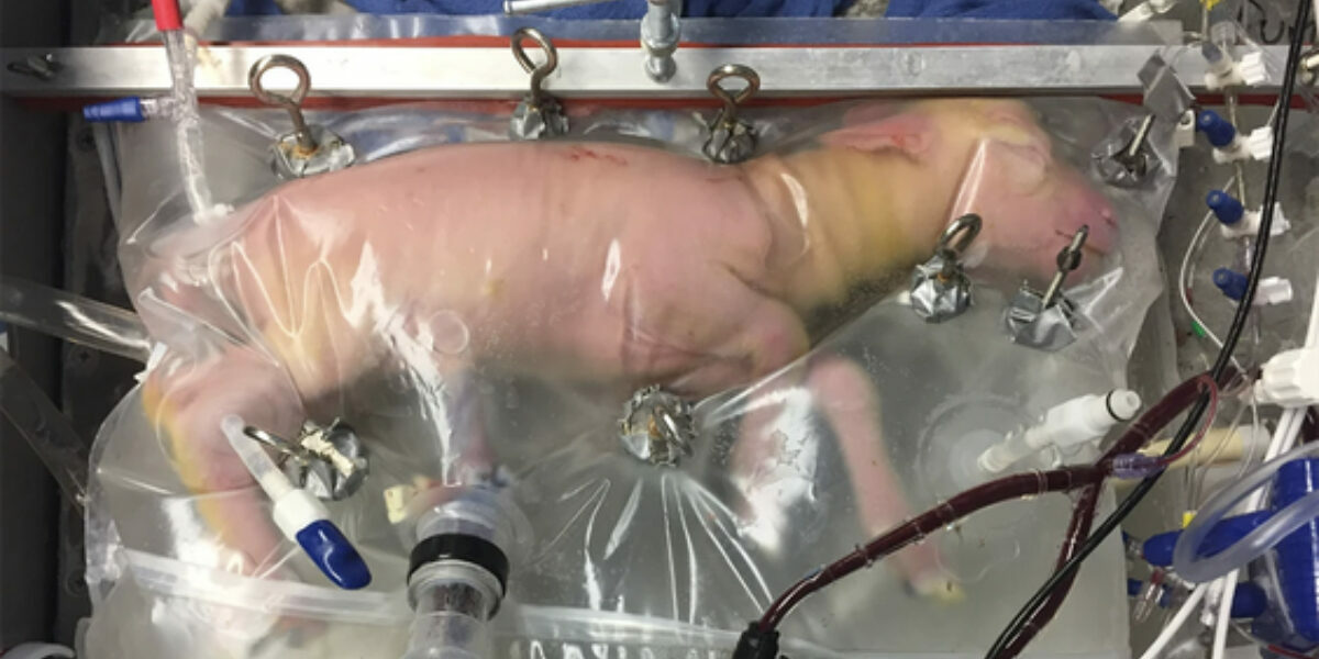 Artificial wombs are coming. Could babies soon be grown outside a woman’s body?