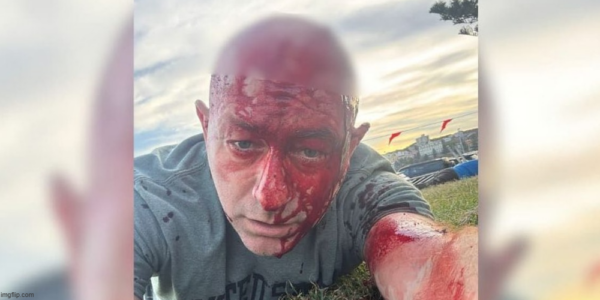 Rick Ekstein: Mark Carney has inflamed antisemitism. Will Canada too pay a price?